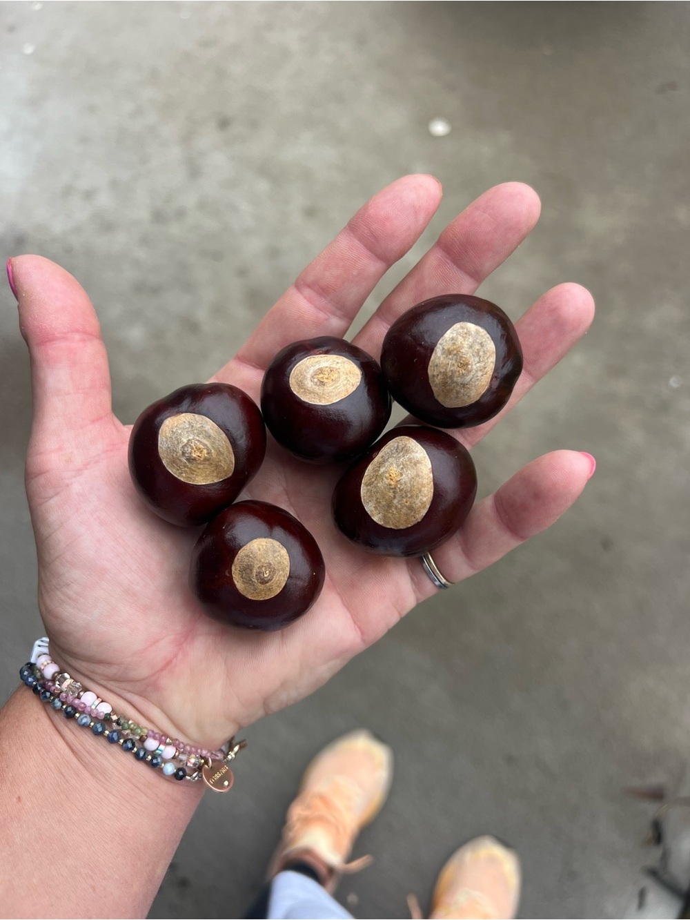 25 XL Jumbo Ohio Buckeye Nuts | Larger than Quarter